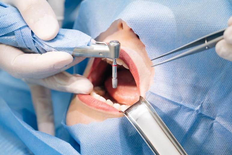 Why Choosing a Qualified Dental Surgeon in Newtown Matters