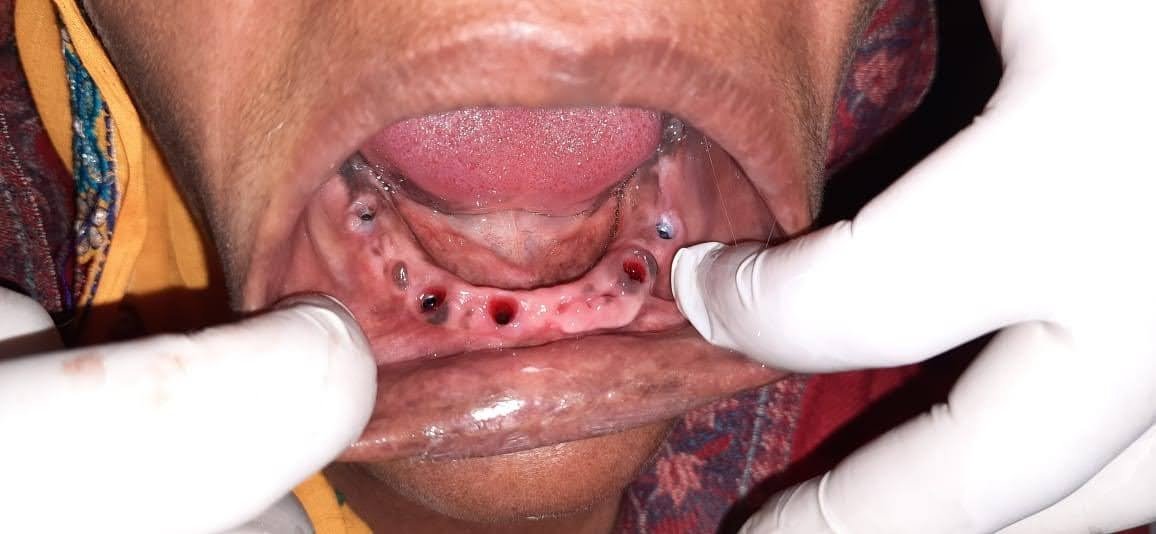 2d93b32a-3748-415c-954e-347ef7b189b2